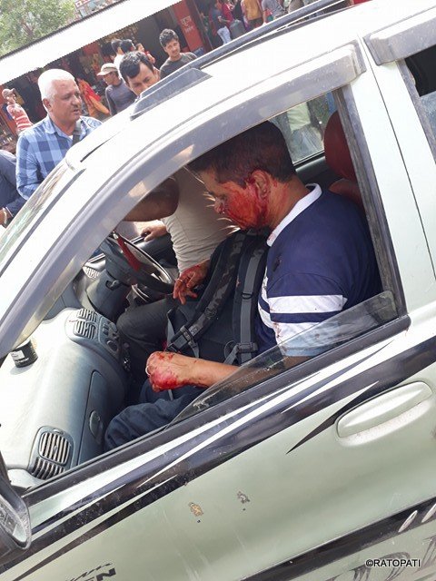   'पाँच वर्ष बित्यो अझै पुल बनेन'