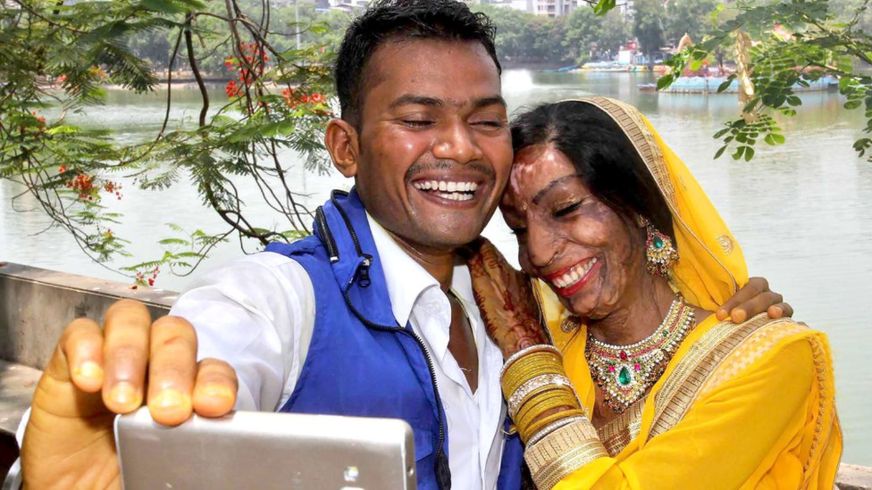   रङ नम्बरका कारण एसिड हमलाकी पिडितले भेटिन् जीवन साथी