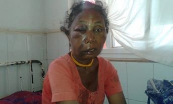   धामीले बोक्सी लागेको सुनाएपछि बृद्धामाथि निर्घात कुटपीट