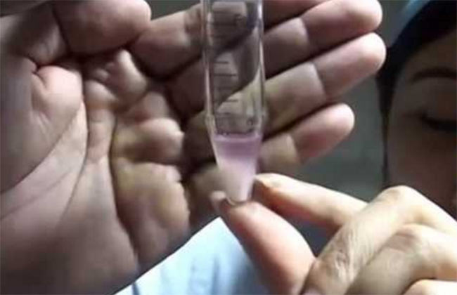 ‘टेस्टट्युब बेबी’ सेवा लिने डेढ सयभन्दा बढी