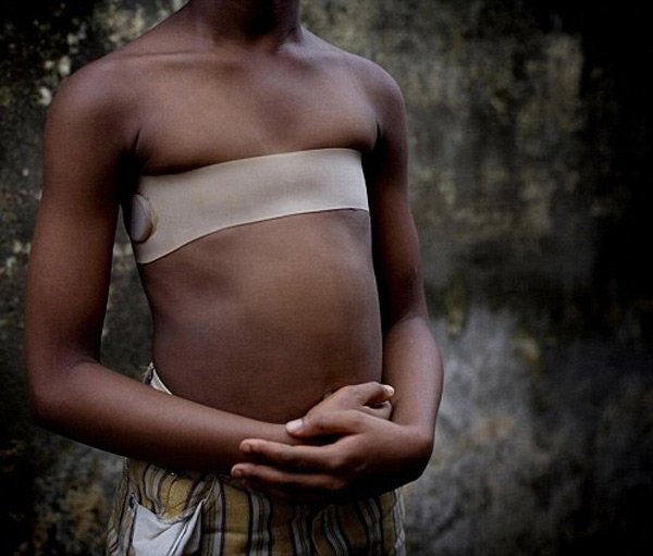 जहाँ बलात्कारबाट जोगाउन युवतीको छातीमा तातो ढुंगा राखेर सम्म पारिन्छ