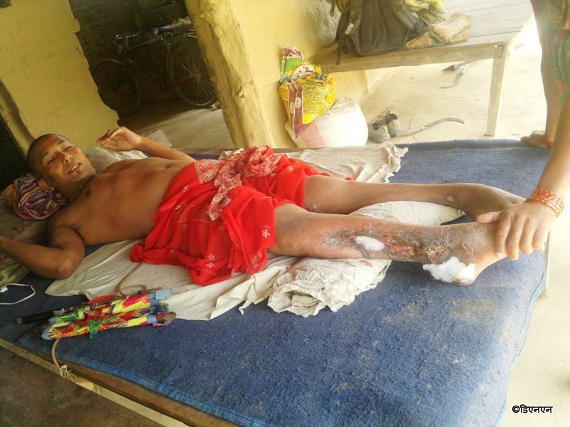   ‘श्रीमानको रिर्पोट आफ्नै देवरहरुले लुकाए !