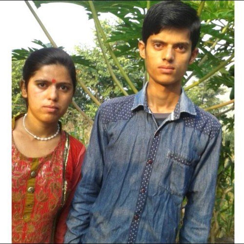 तीन वर्षदेखि सेतो सर्पले यी किशोरीलाई पछ्याउँदै, ३४ पटक डस्नुको पछाडि यस्तो कारण ?