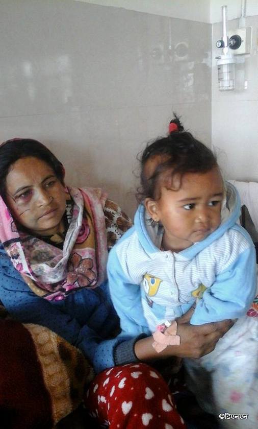   काष्ठमण्डप एयर दुर्घटनाका घाइतेको बयान : तीन पटक खट्याक–खट्याक गर्यो, पङ्खाको गति कम हुन थाल्यो