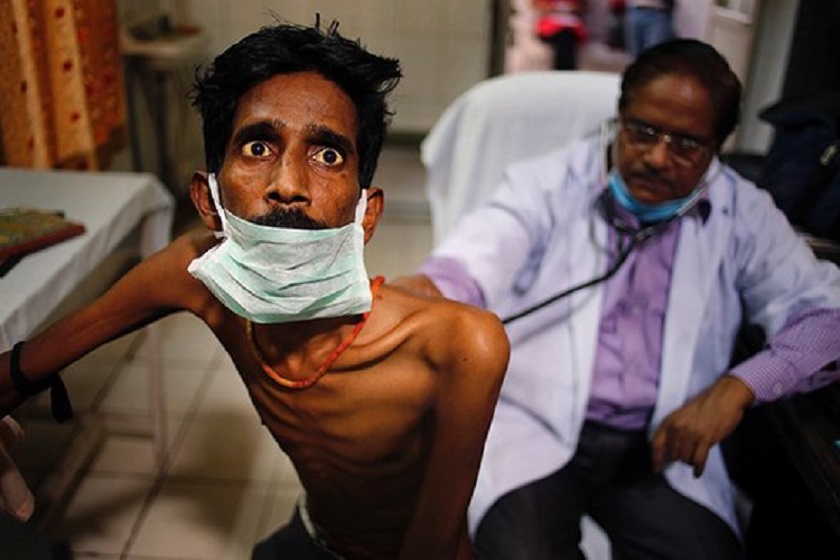२१ लाखभन्दा बढी भारतीयमा क्षयरोग संक्रमण