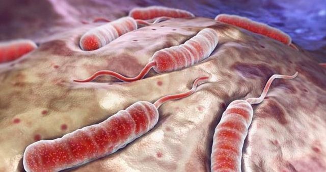 Cholera kills 9 in Nigeria