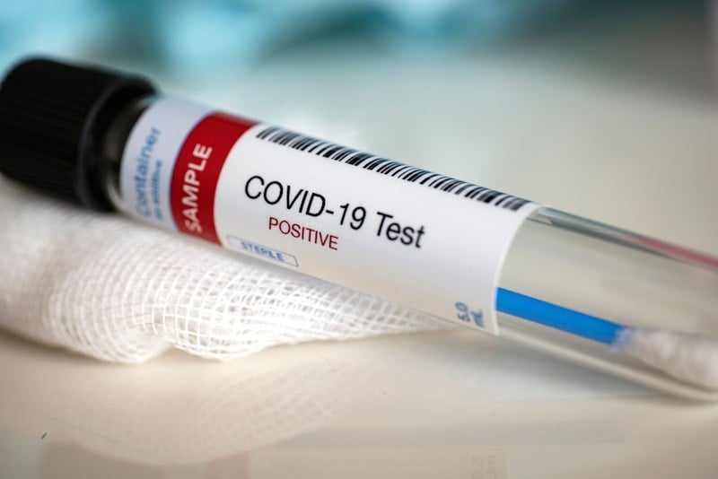 COVID-19 testing lab launched in Bhaktapur
