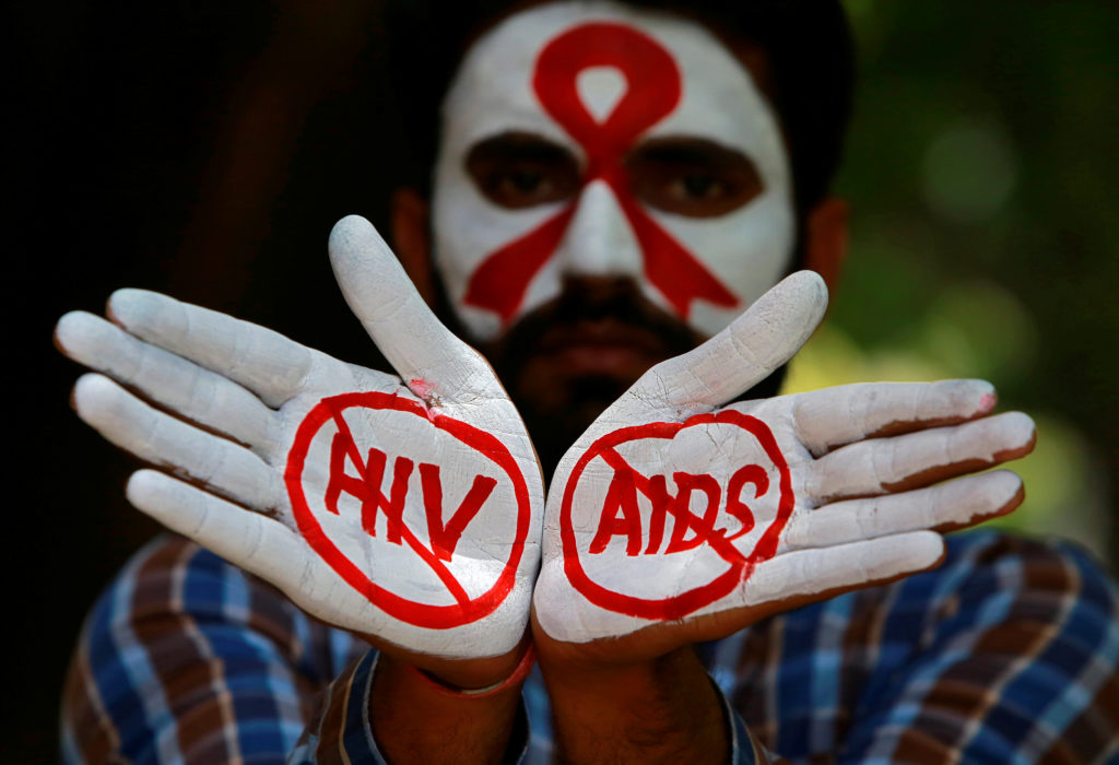 एड्सको अन्त्य ? : औषधी लिइरहेका एचआईभी संक्रमितसँग असुरक्षित यौनसम्पर्क गर्दा पनि भाइरस सरेन !