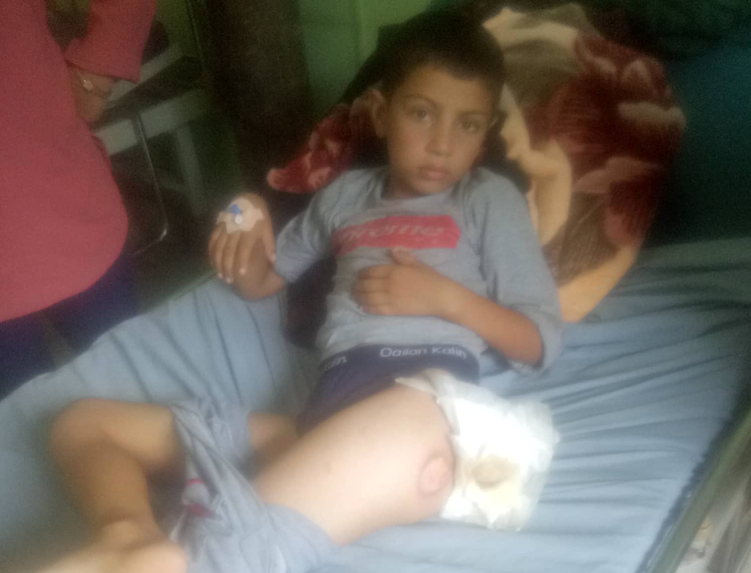 डाक्टरको लापरबाहीले डेढ महिनादेखि ओछ्यानमा ११ वर्षीय बालक, मेडिकल काउन्सिलमा पर्‍यो उजुरी