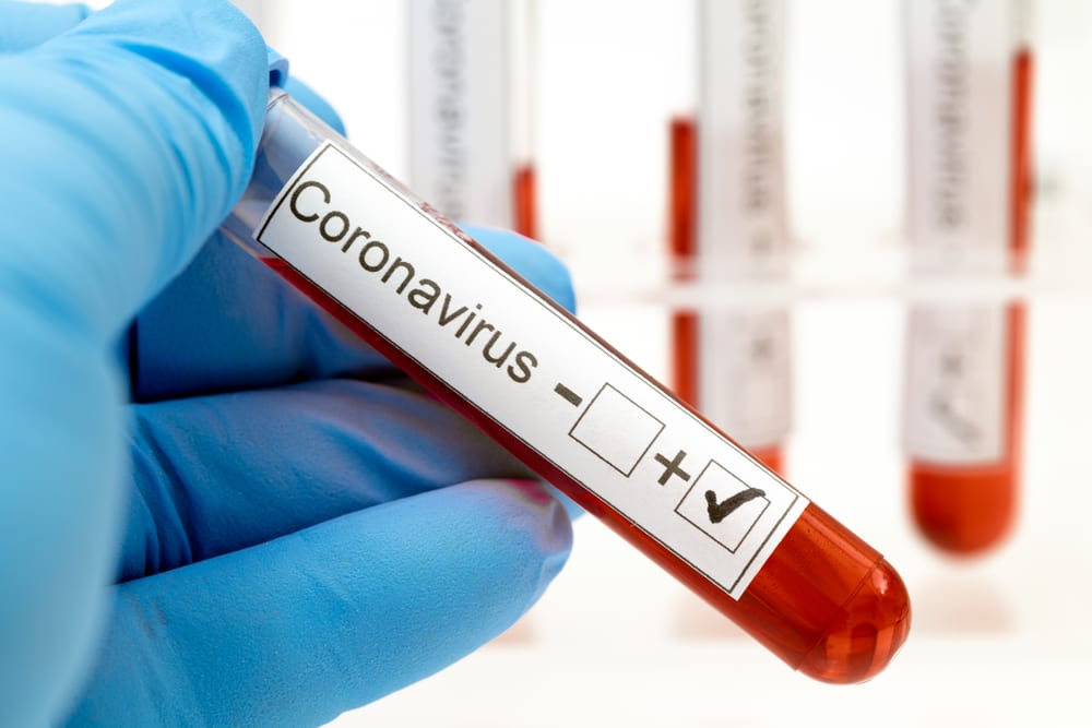 Coronavirus kills one person, 106 more infected