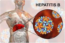 Hepatitis 'B' reaches to an alarming level in Dolpa