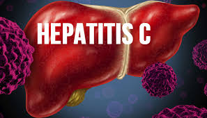 69 dialysis patients infected with Hepatitis C in east China hospital