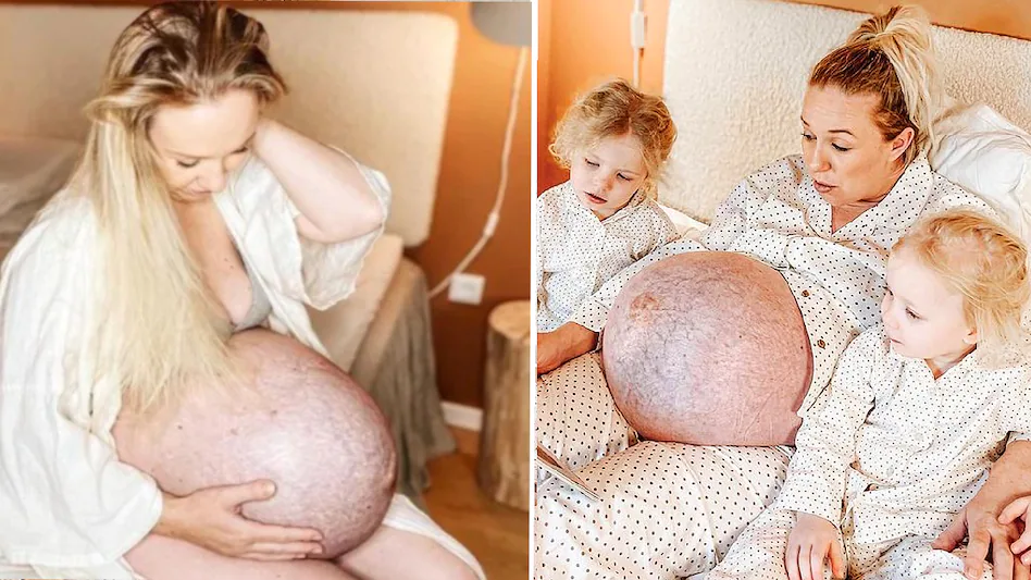 यी गर्भवती महिलाको पेट देखेर आश्चर्यमा परे मानिस
