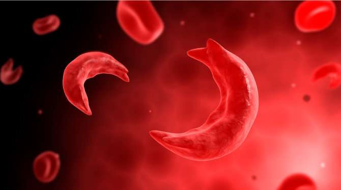 Research to find out status of sickle cell afflicting Tharus