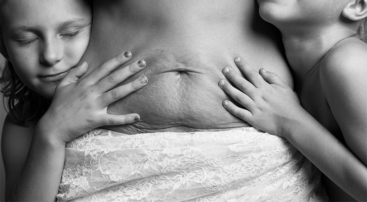 फोटोग्राफरले गर्भाधानपछि महिलाको शरिर देखाइन् जुन म्यागजिनमा राखिने जस्ता छैनन्