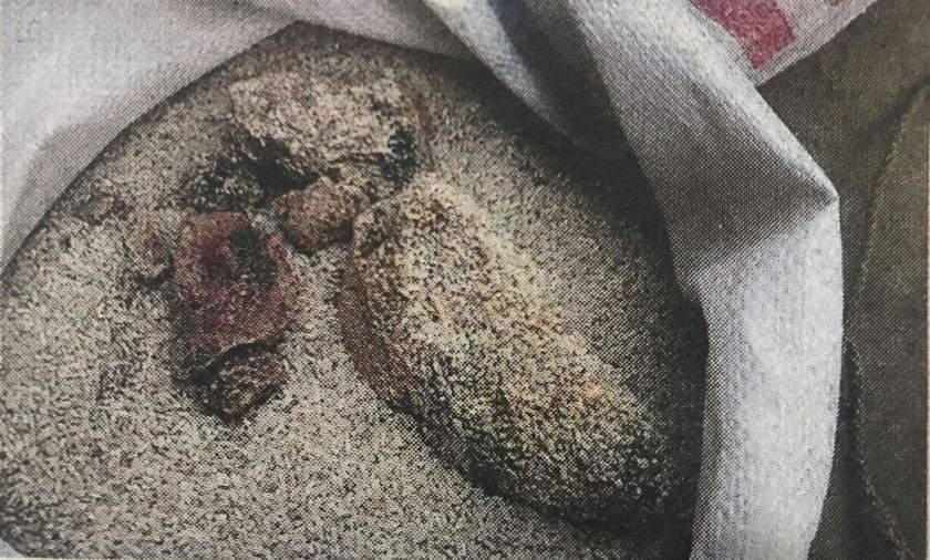 गरिबलाई कुहिएको चामल