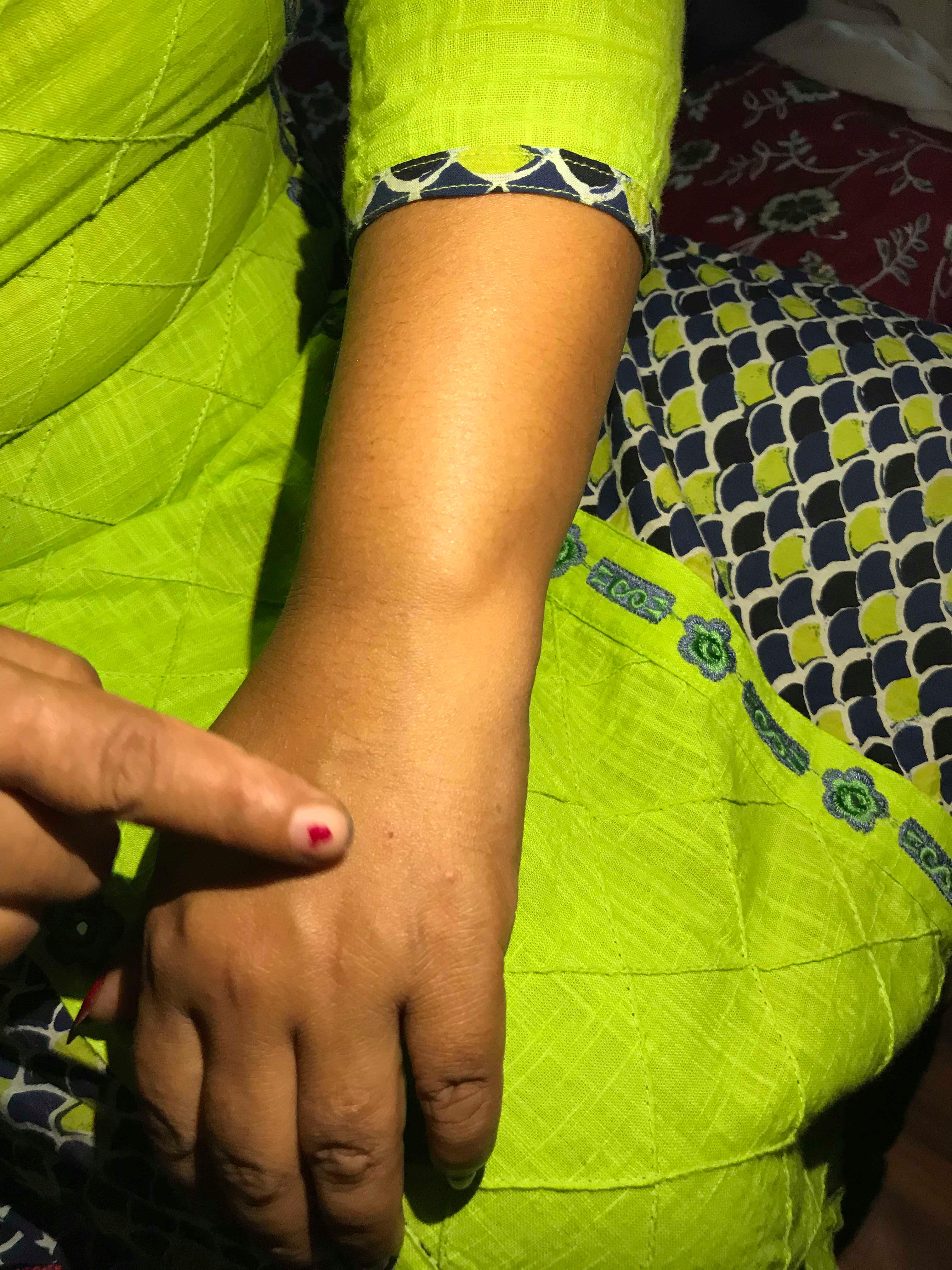 बनेपामा युवतीमाथि सिरिञ्ज प्रहार