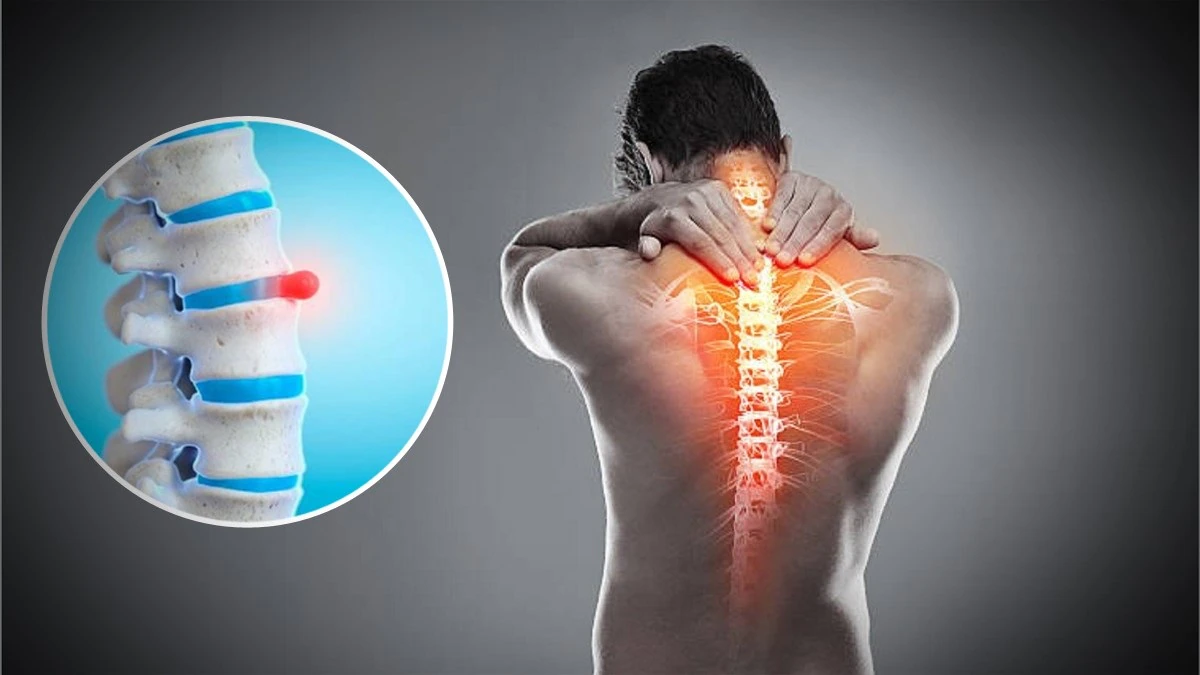 ढाड र हातगोडाको दुखाई 'स्लिप डिस्क'को संकेत