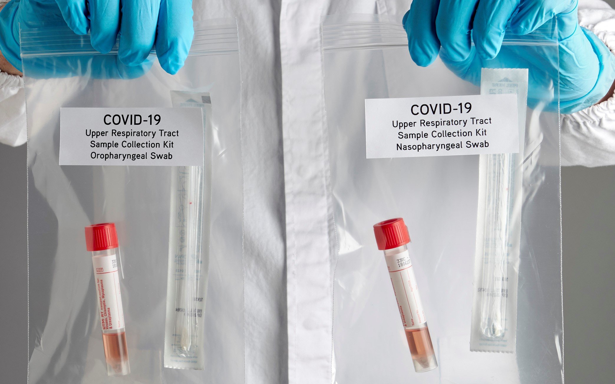 State 2: Over 2,000 samples collected for test for coronavirus