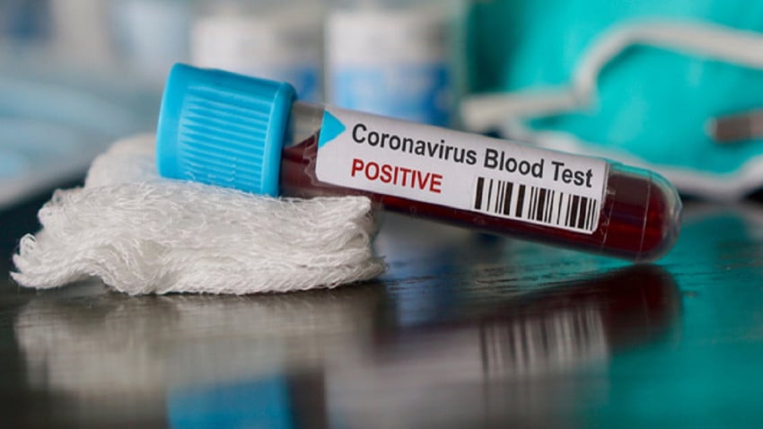 Relatives of COVID-19 infected test negative in RDT