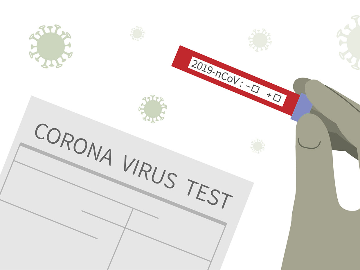 ‘Expand the scope of COVID-19 tests in Sudurpaschim State’