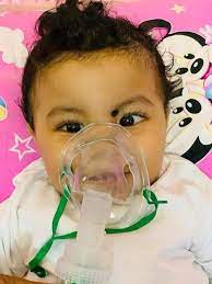 Funds being raised for treatment of nine-month-old Usman