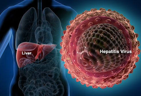 Disease with similar symptoms of hepatitis detected