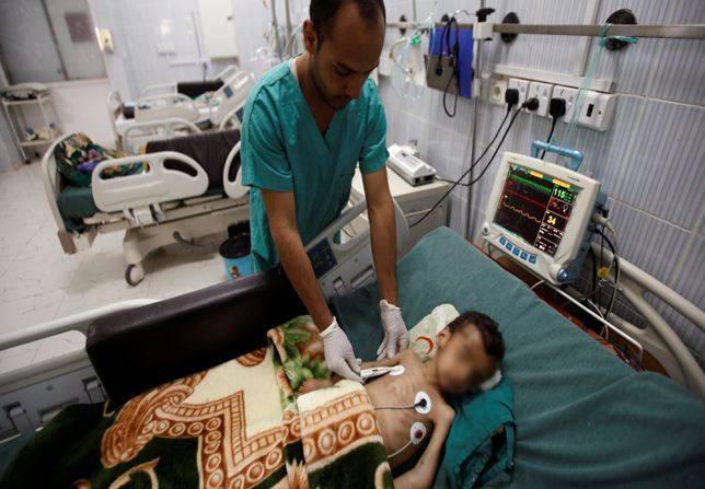 Yemen cholera cases could pass 300,000 by September: UN